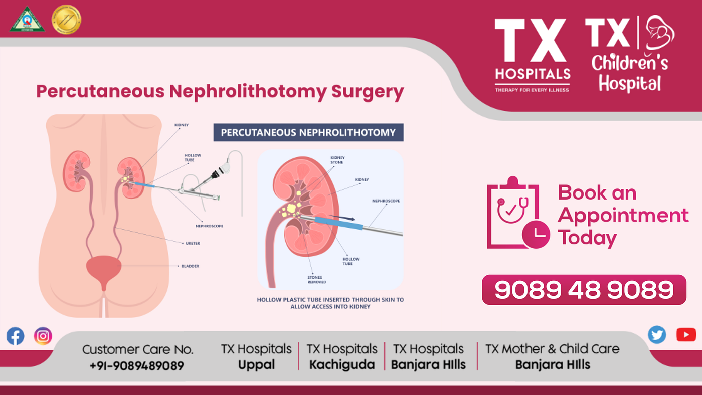 Understanding the Cost of PCNL Surgery for Kidney Stones in Hyderabad: Insights from TX Hospitals
