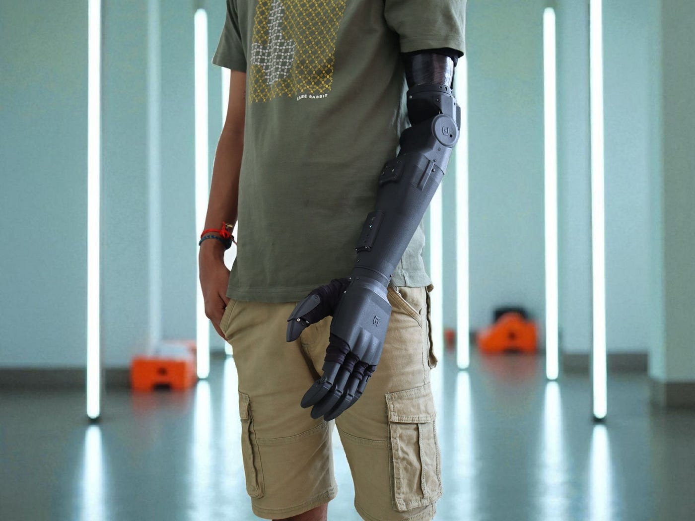 First-Time Bionic Arm User? Here’s What to Expect