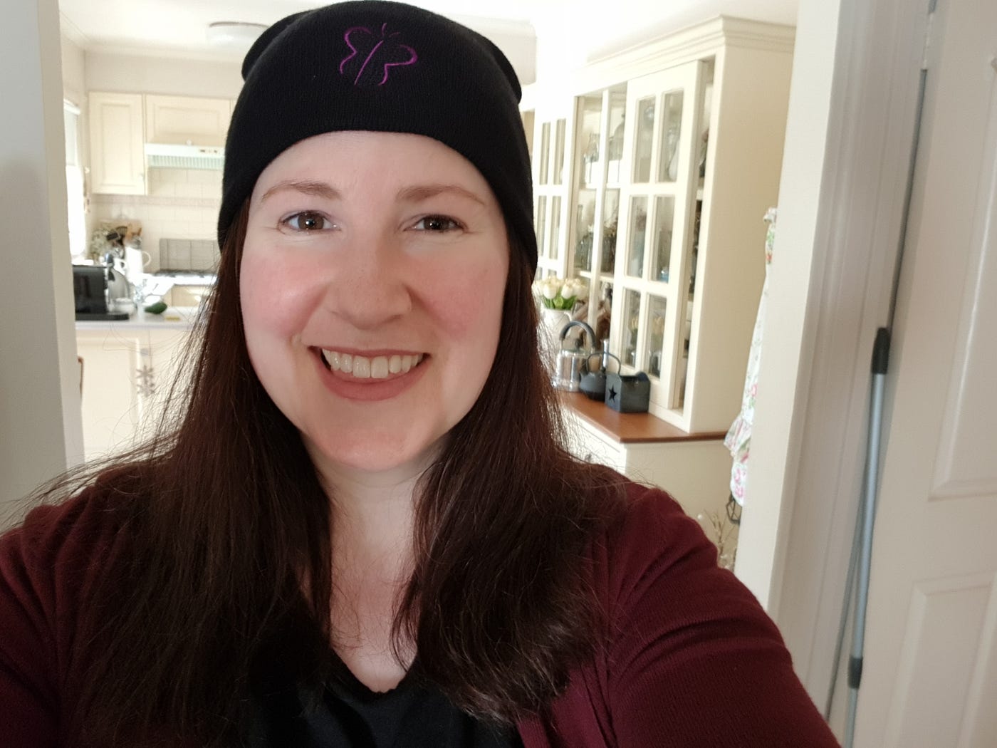 Rachel’s story living with lupus