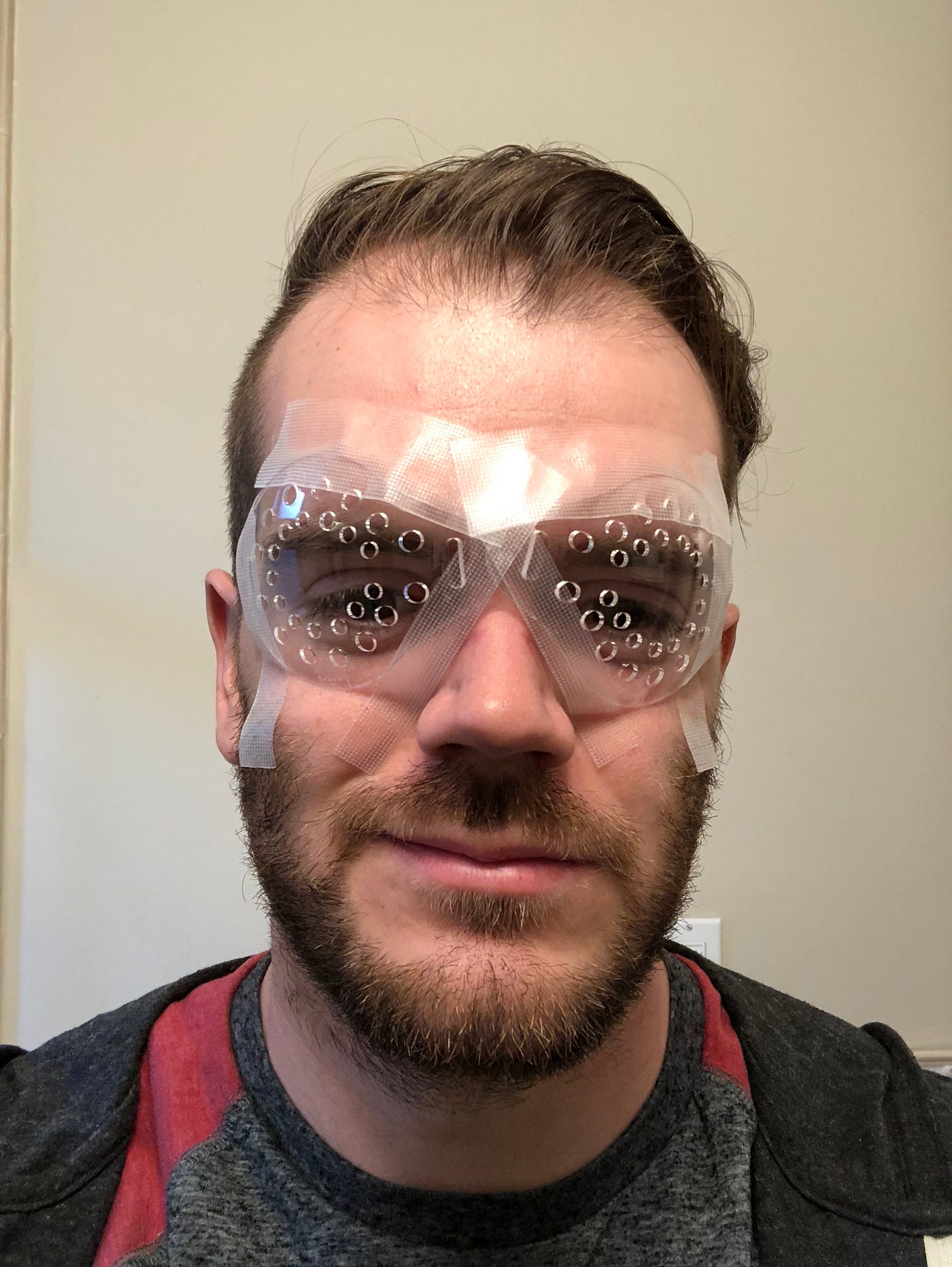 I had LASIK surgery and this is what it was like | by Duncan Ariey | Medium
