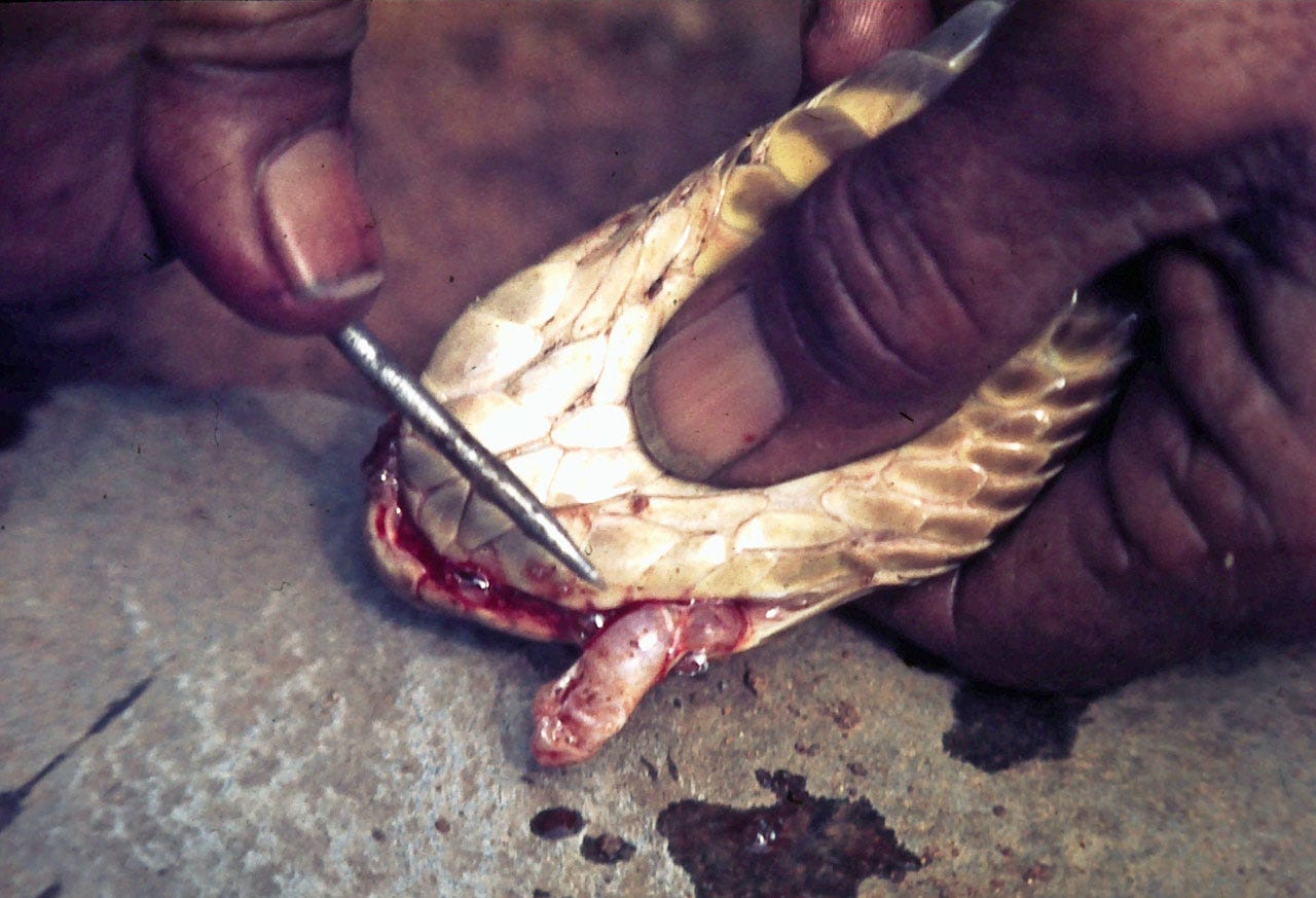 Snake Catcher's Harrowing Story Of Surviving A Brown Snake Bite