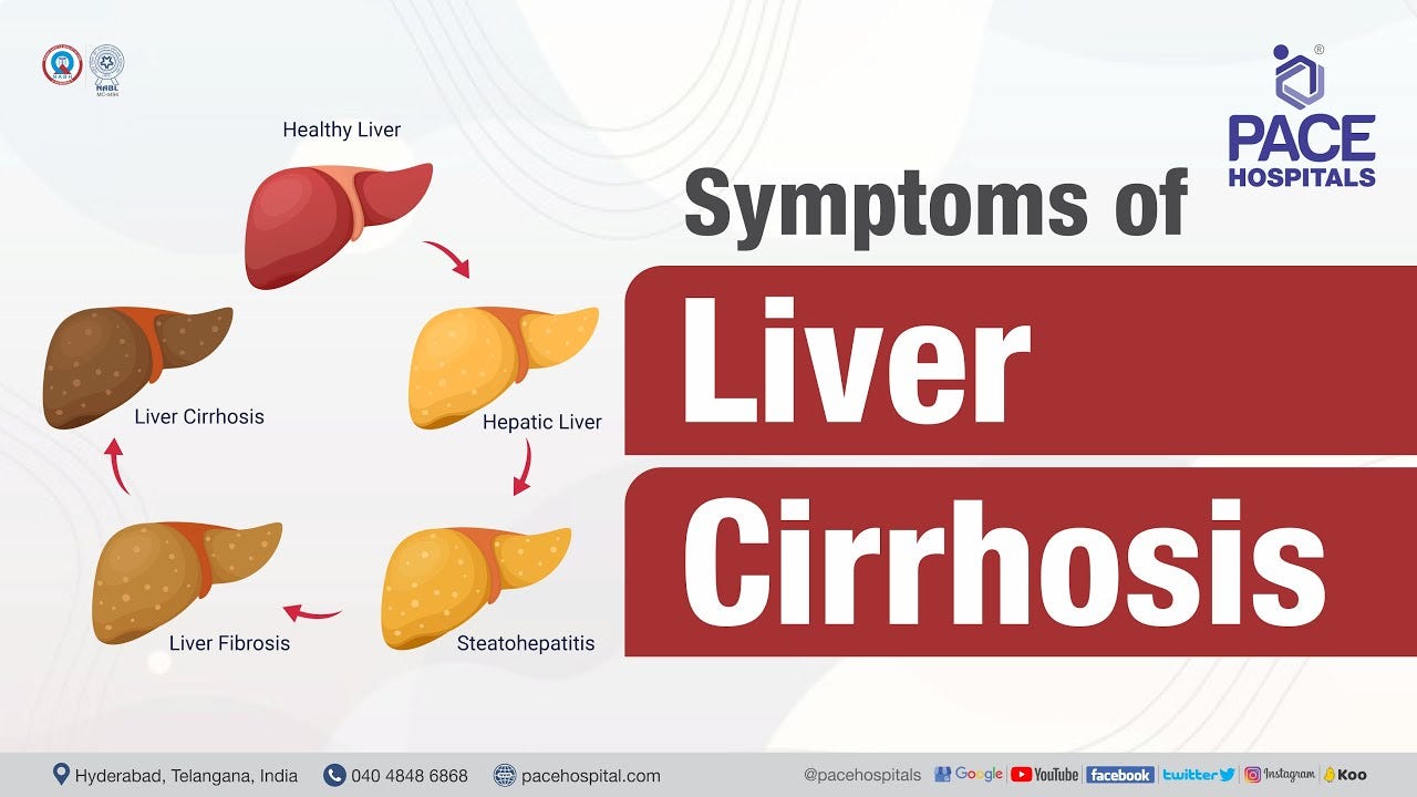 liver cirrhosis symptoms