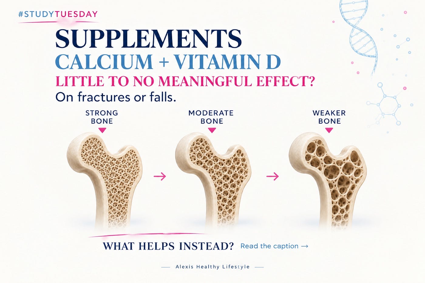 Are You Taking Calcium and Vitamin D for Your Bones?