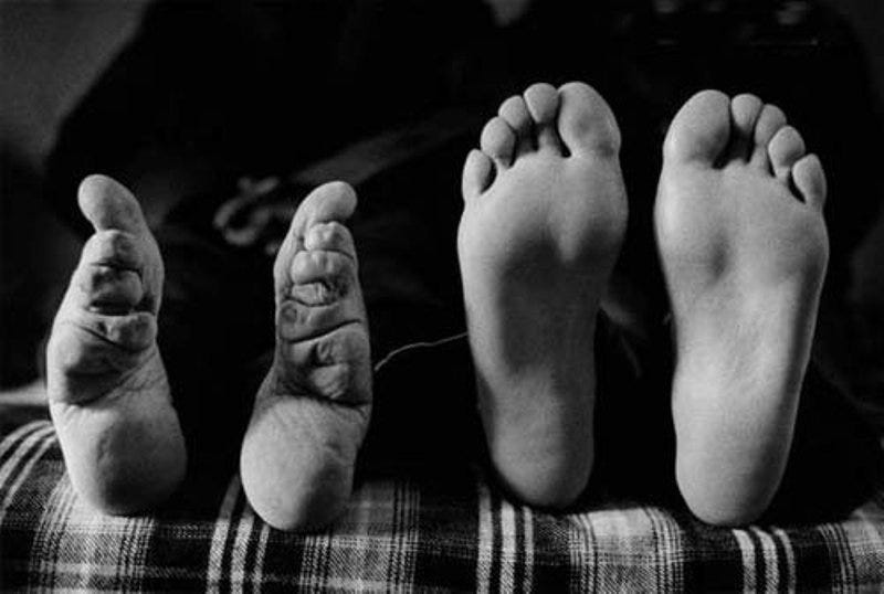 Bound Asian Feet - The Disturbing Tradition of Foot Binding in China | Short History