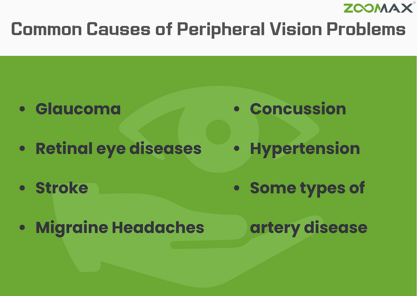 Tunnel Vision (Peripheral Vision Loss): Symptoms, Causes, Treatments