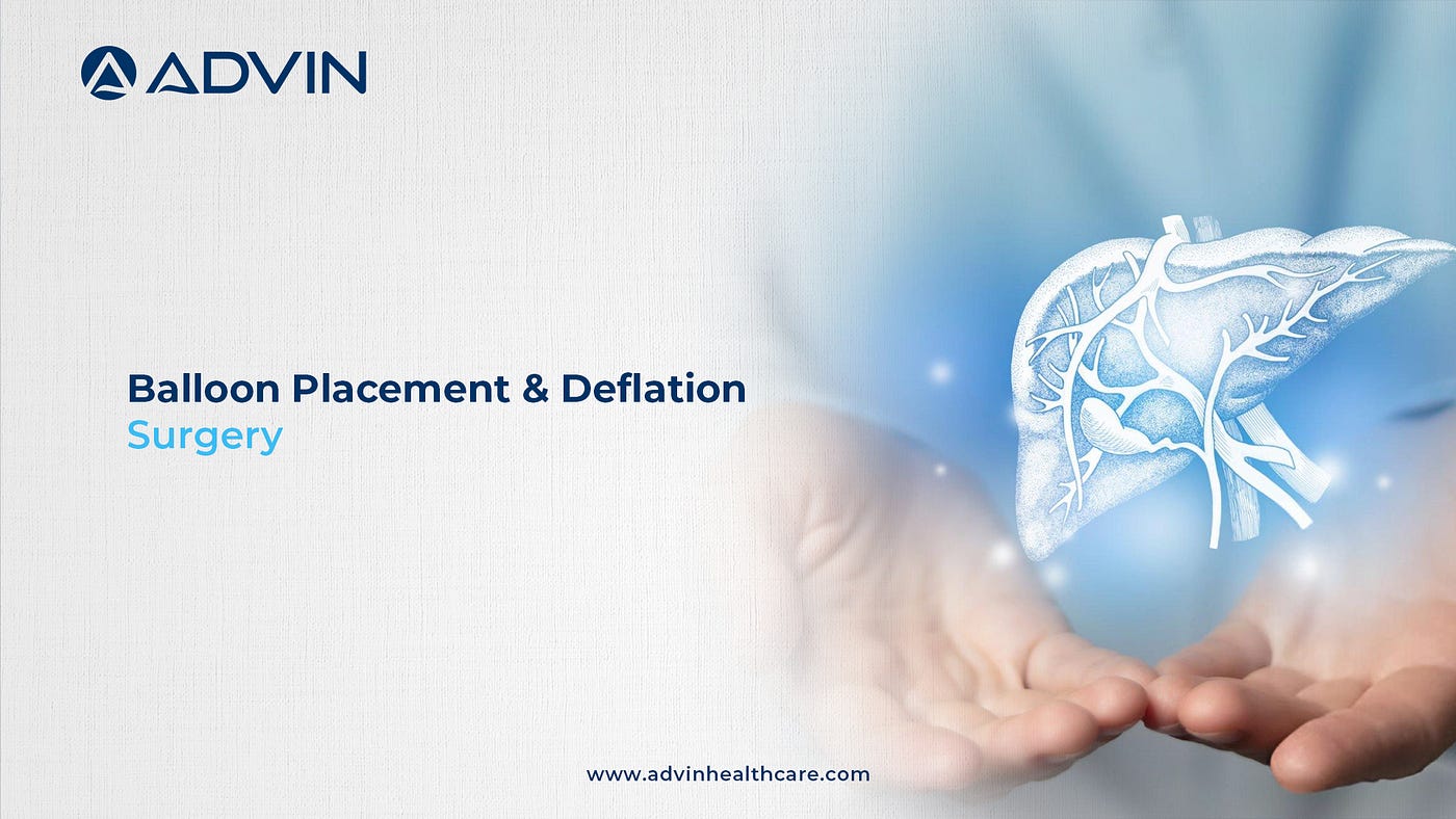 Balloon Placement & Deflation Surgery: A New Gastroenterology Approach