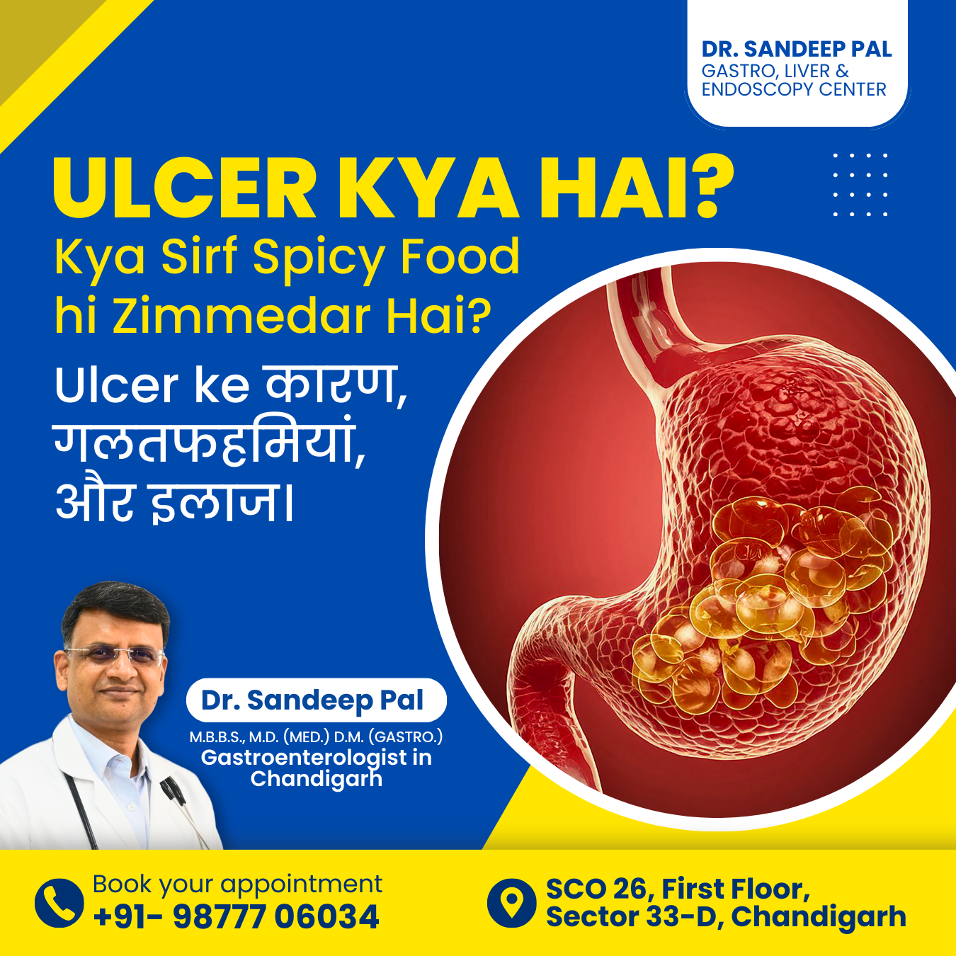 All About Ulcers ulcer kya hota hai
