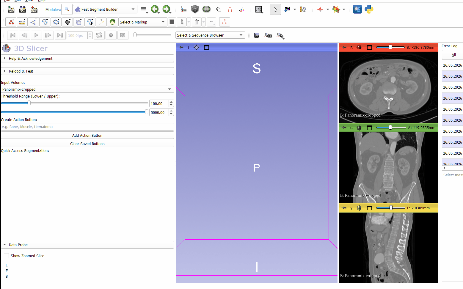 Module for 3D Slicer called Fast Segment Builder.