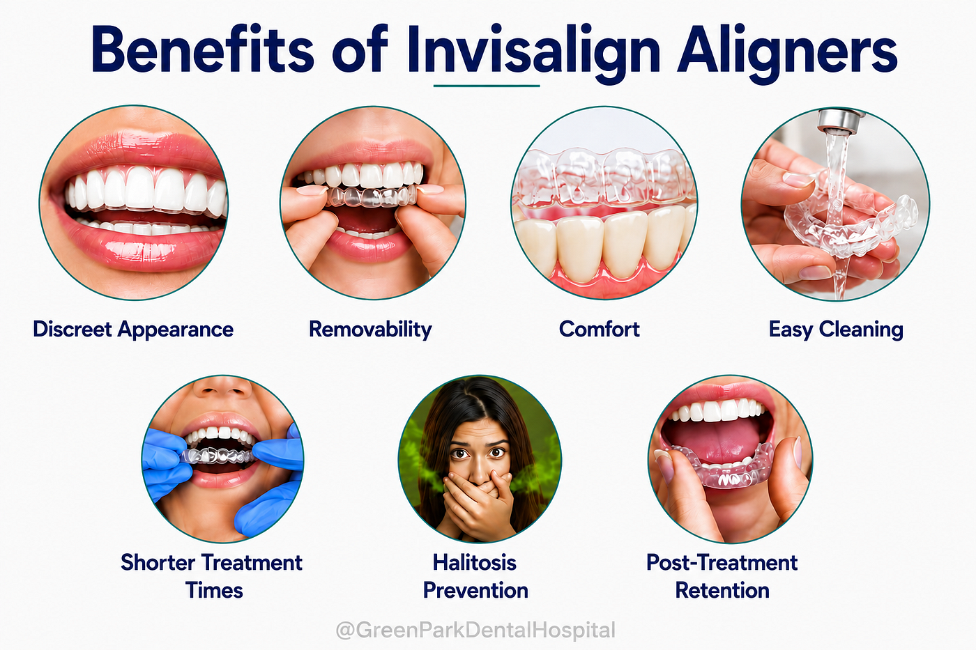 Benefits of Invisalign Aligners | Dr Syed Arshad Javeed