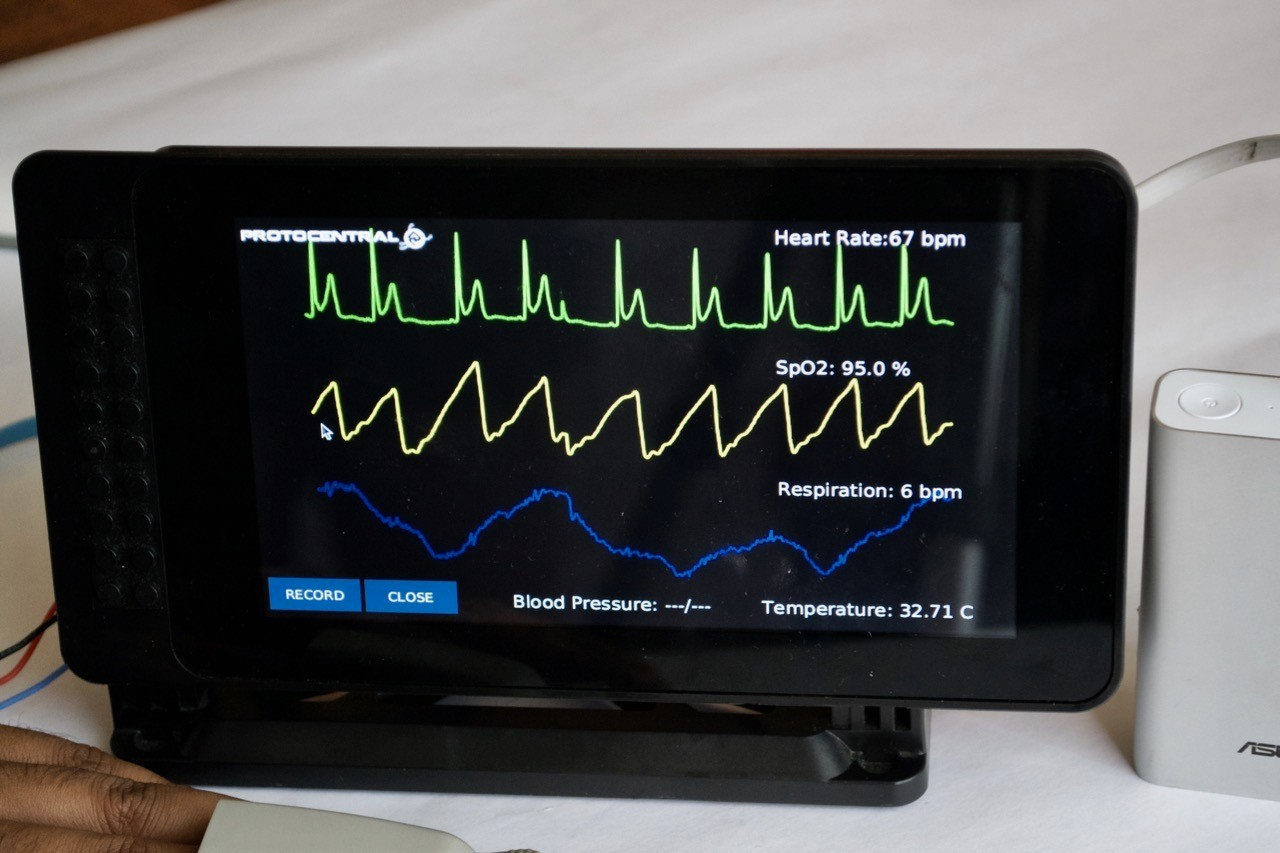 Temp monitoring. Monitoring devices. temperature monitoring. температурный монитор 218. мониторинг температуры человека.