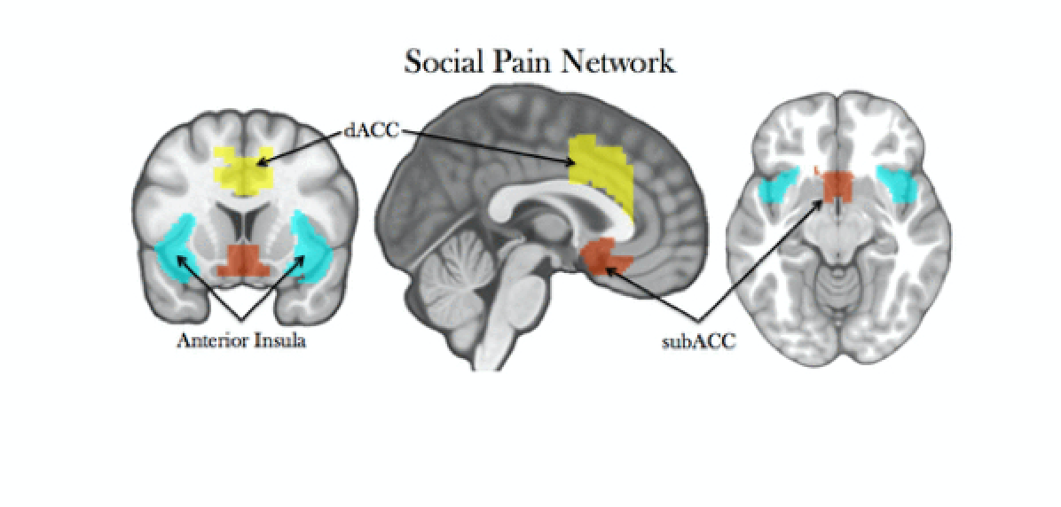The Neuroscience of Narcissism. Narcissism is a popular word being