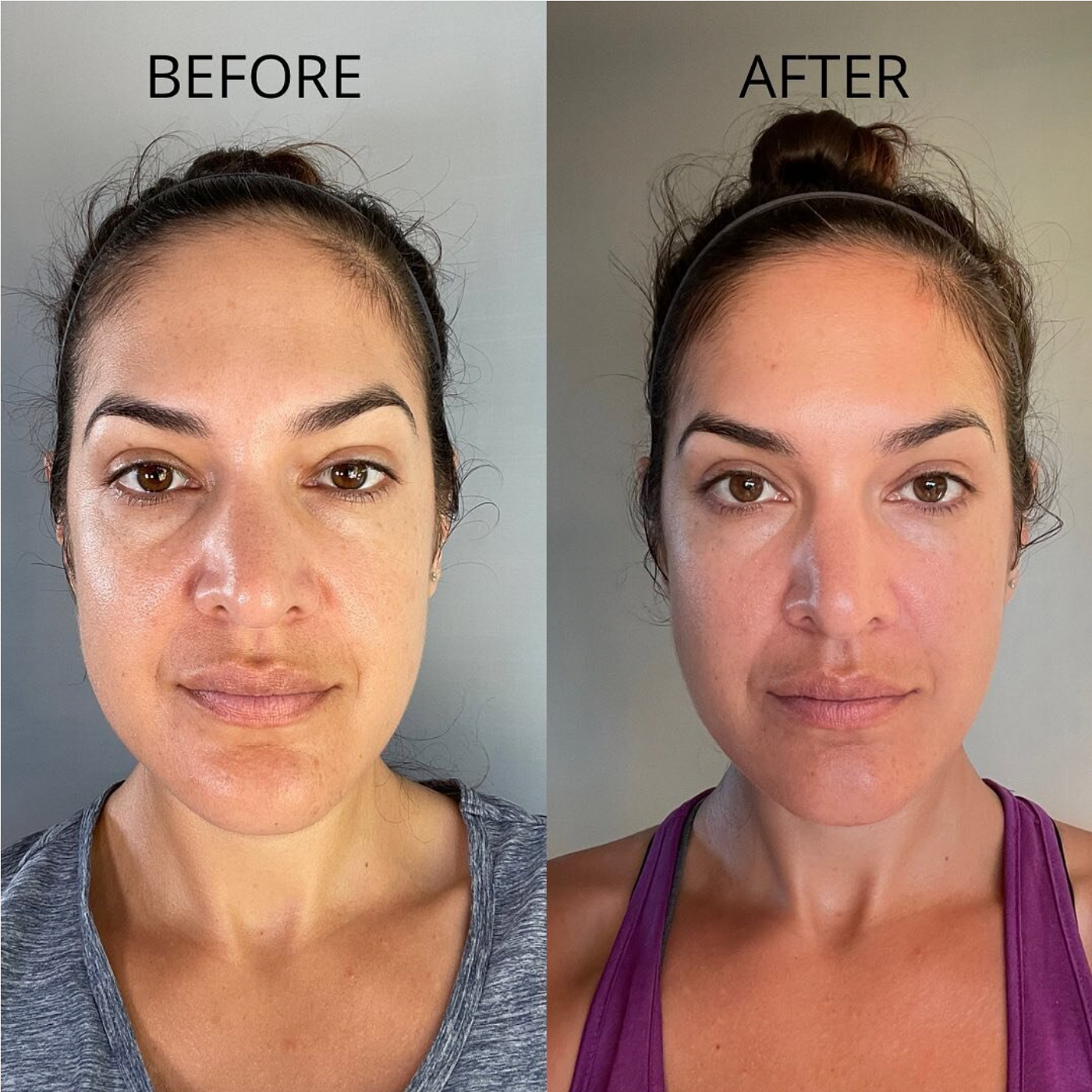 Facial Gua Sha Demystified: Science Behind the “Natural Face Lift” | by  Logan Hailey | Medium