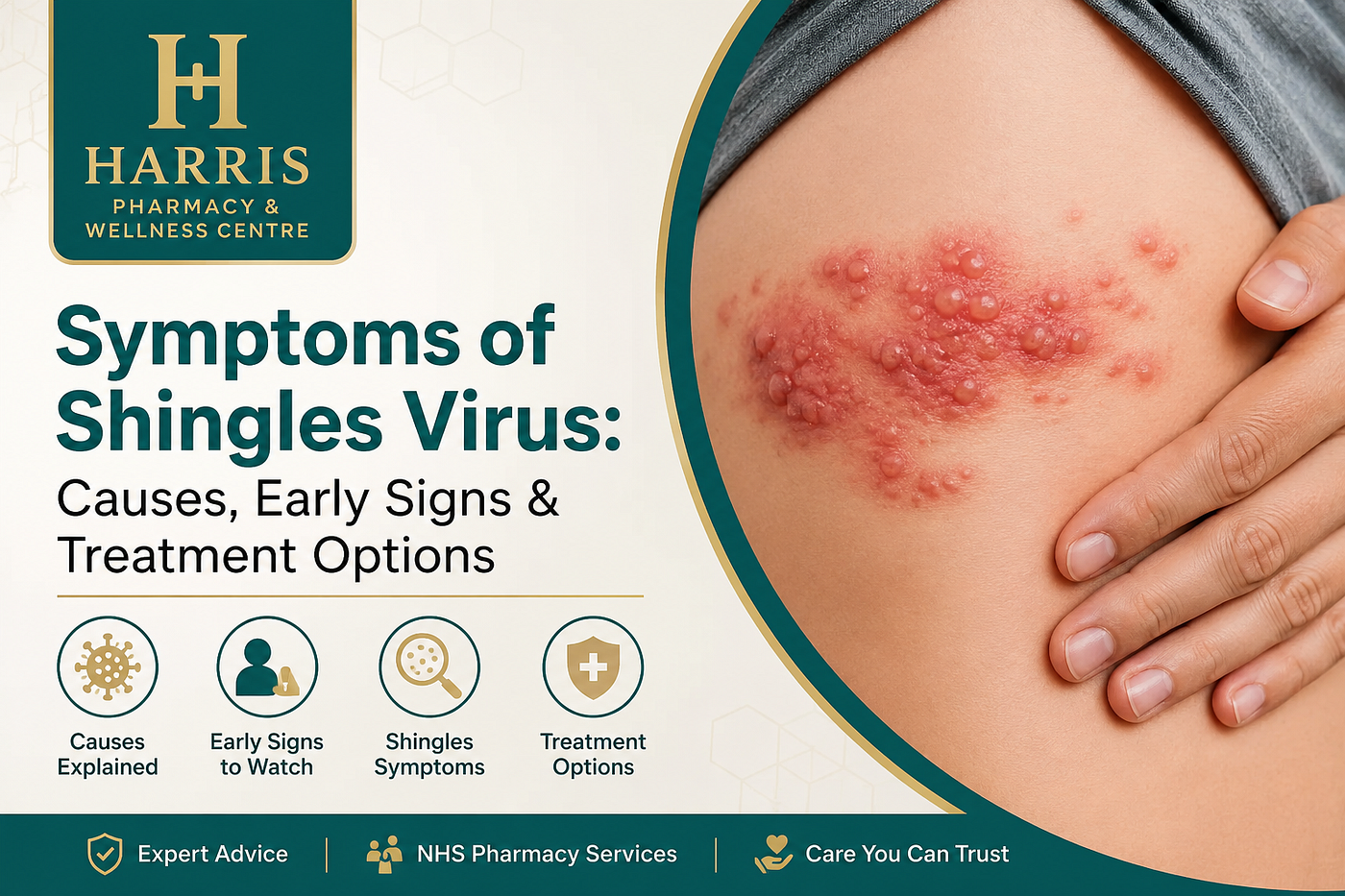 The Warning Signs of Shingles Most People Miss