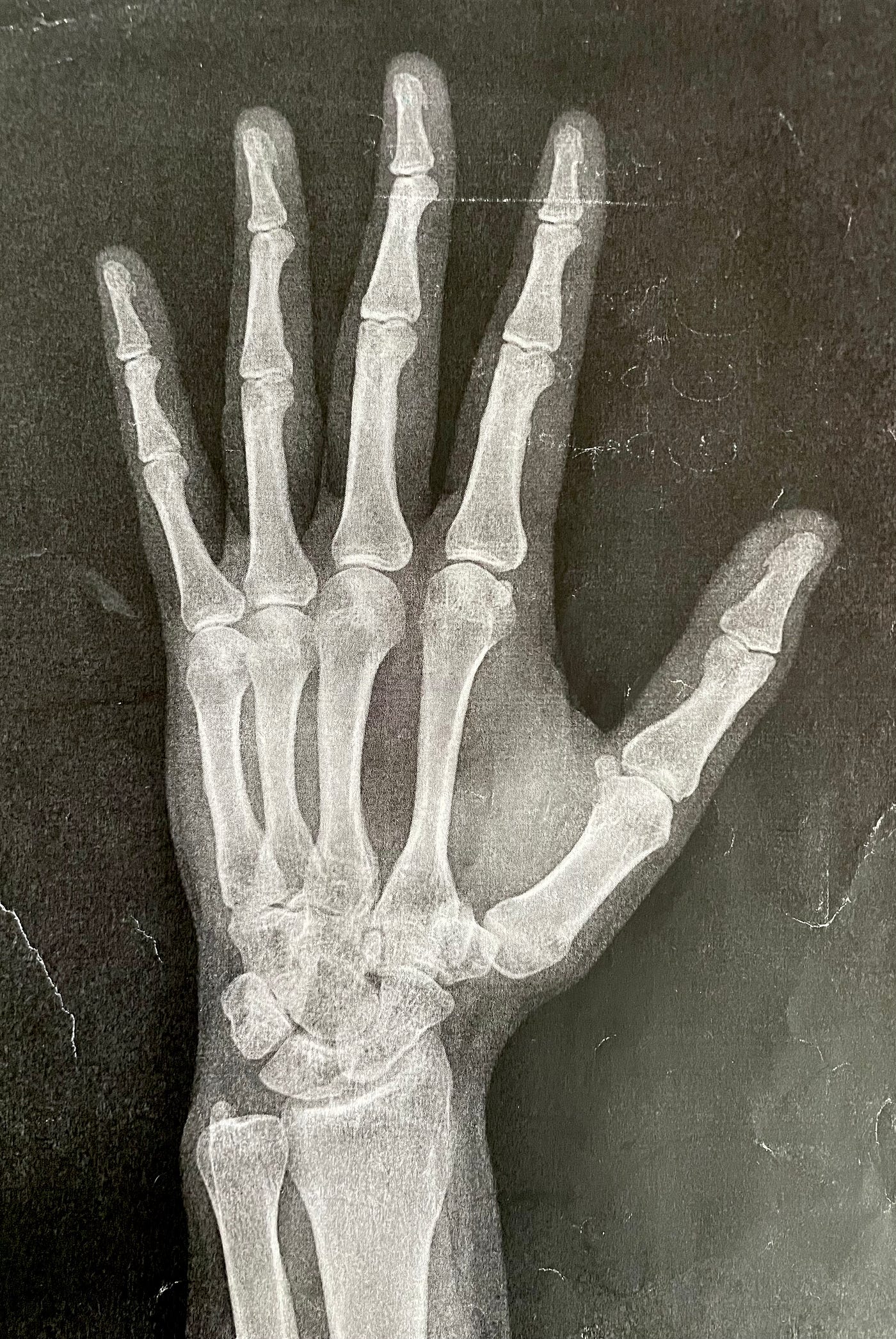 Sometimes medical scares turn out surprisingly well