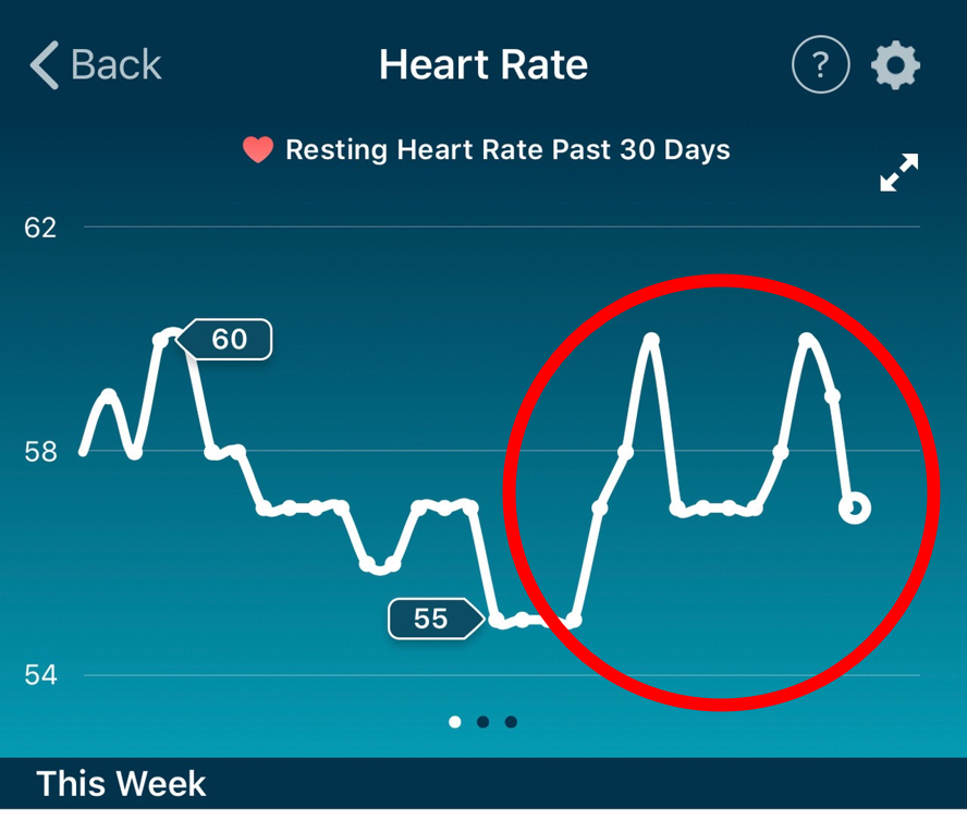 When Your Fitbit Your Heart is Exploding Should You | by Andrew Jamieson | Towards Science