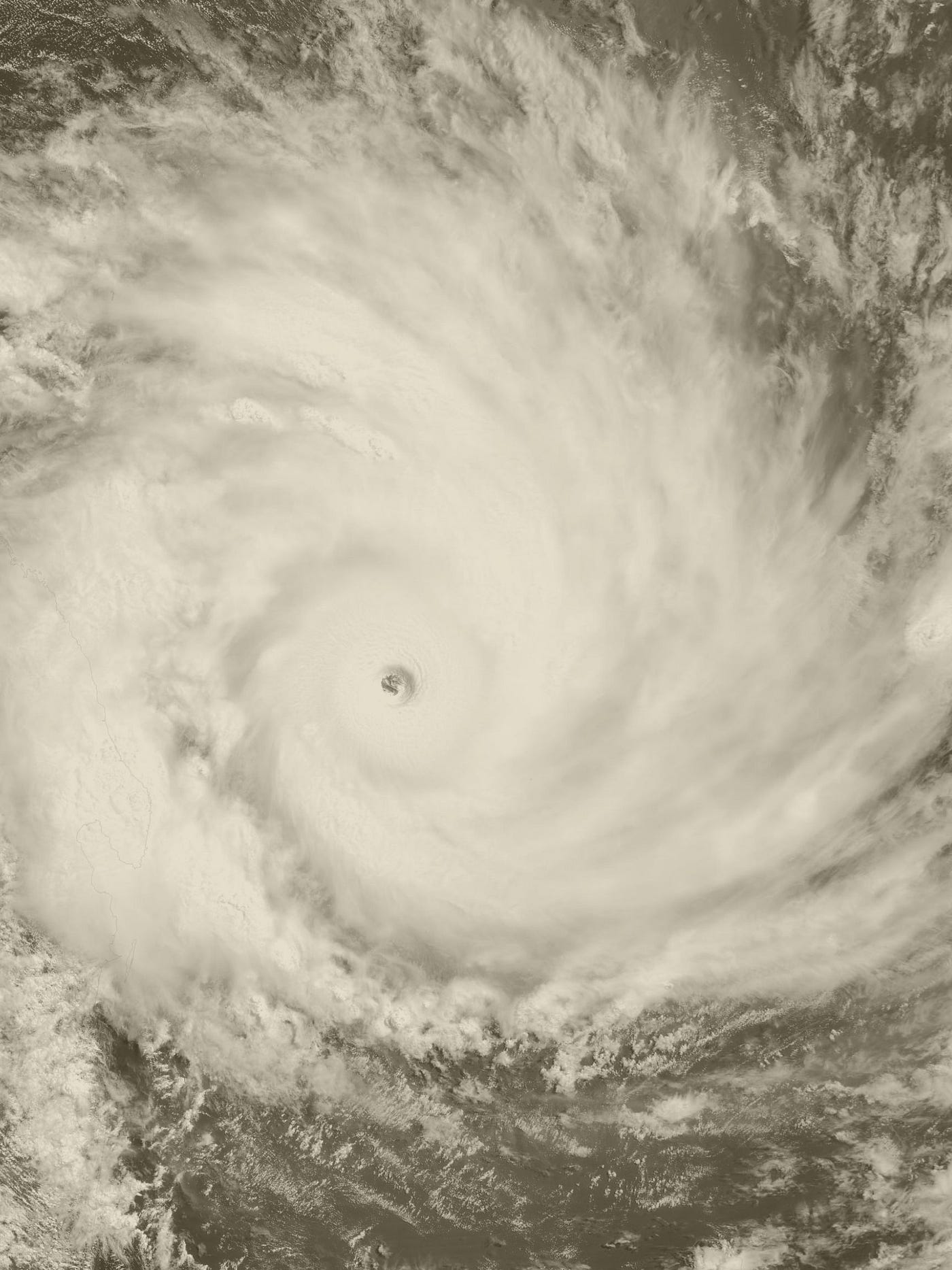 Orthopedic Injury Patterns and Prevention During Hurricane Preparedness in South Florida — Dr.