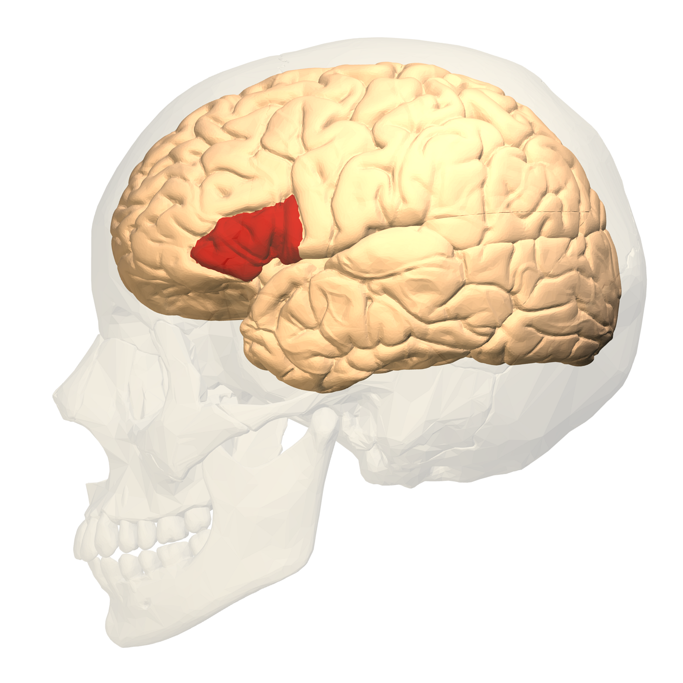 What is Broca’s Aphasia? Symptoms, Causes, and Treatment Methods