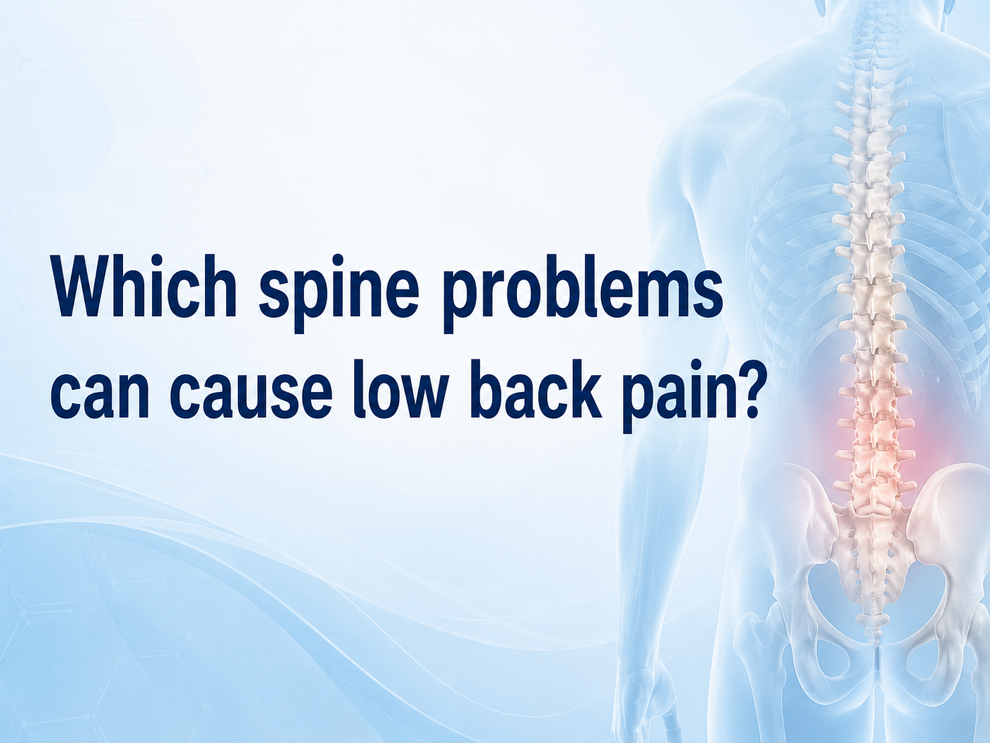 Which spine problems can cause low back pain?
