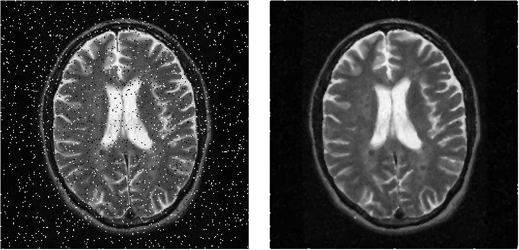 Median Filtering with Python and OpenCV | by Tony Flores | Medium