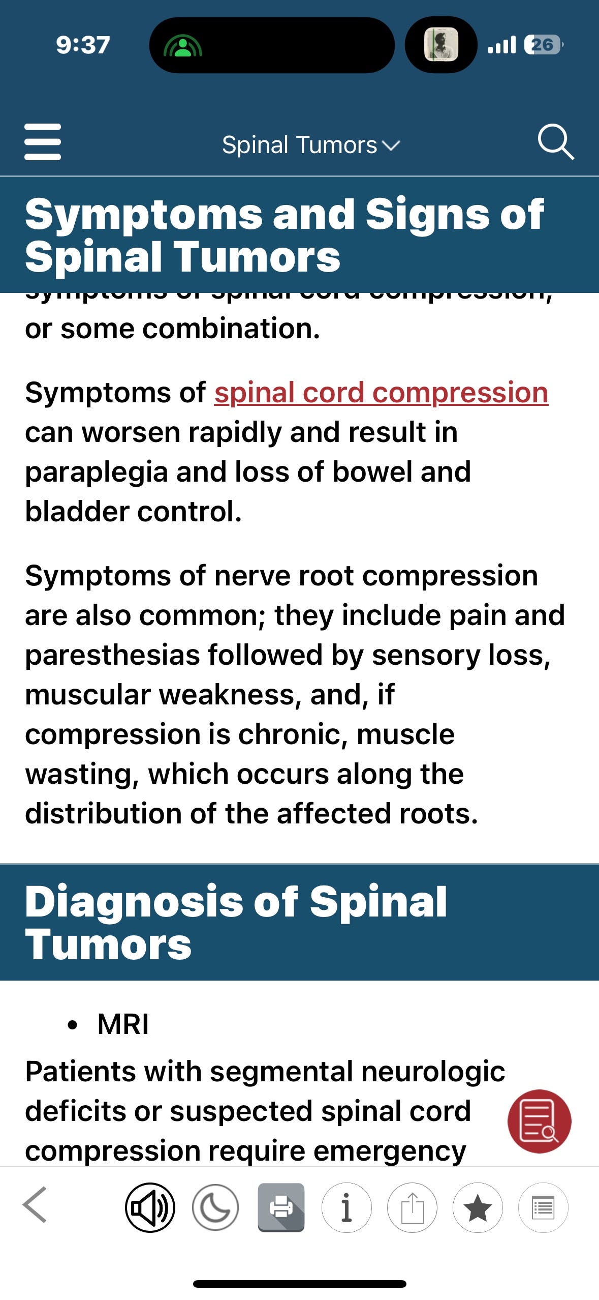 Spinal Cord Compression - Neurologic Disorders - Merck Manuals Professional  Edition