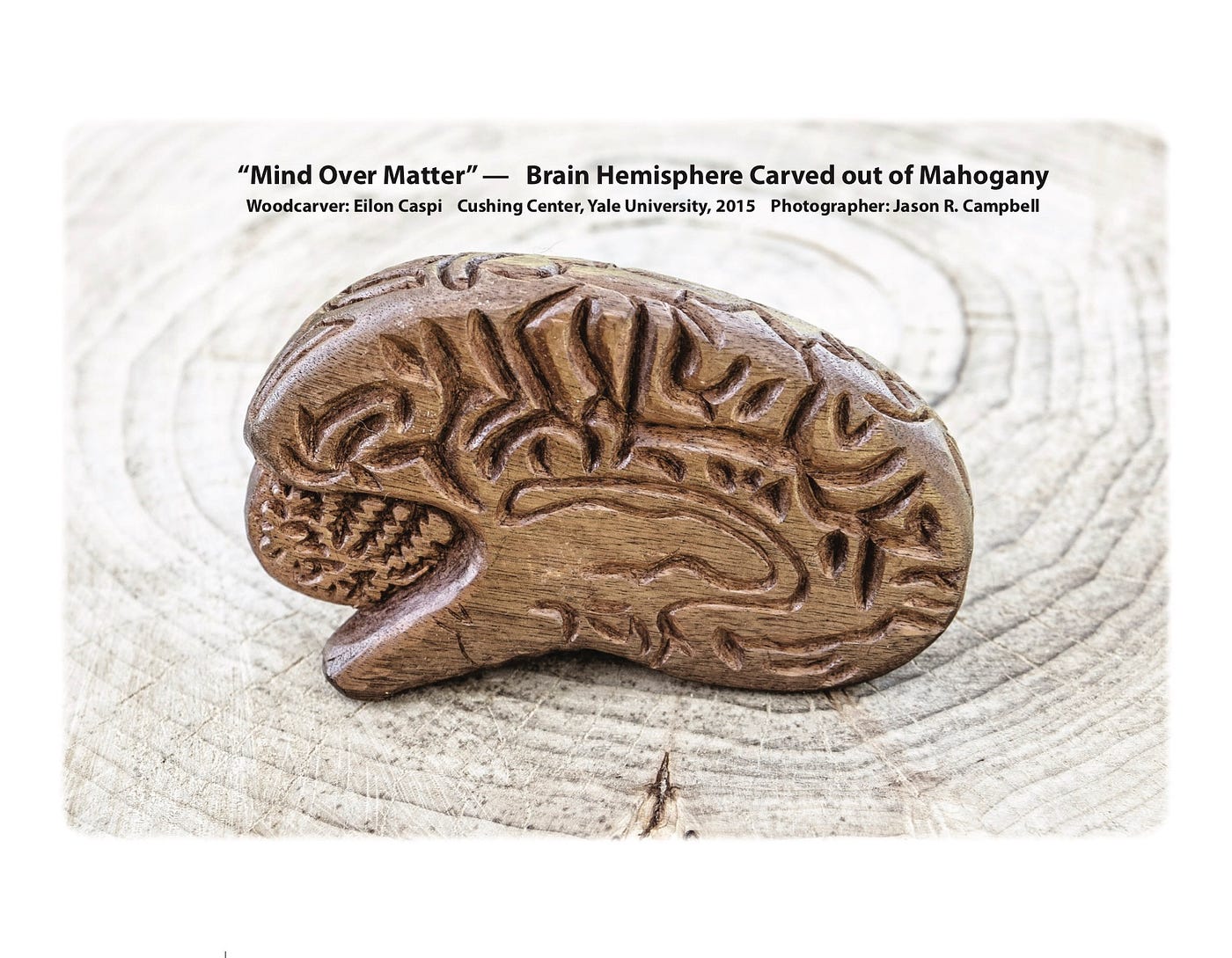 Trust at Stake: Alzheimer’s Association’s role in FDA’s approval of Aduhelm