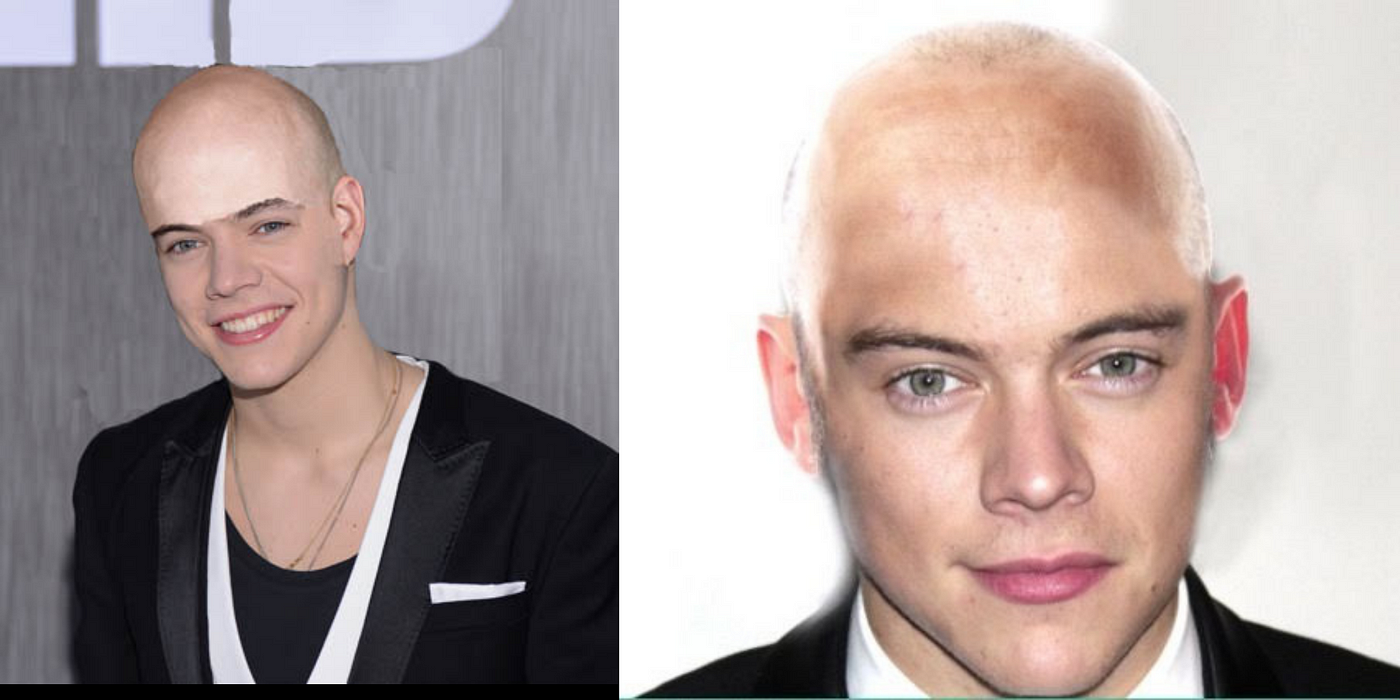 Harry Styles' Hair Transformation: Photos Over the Years