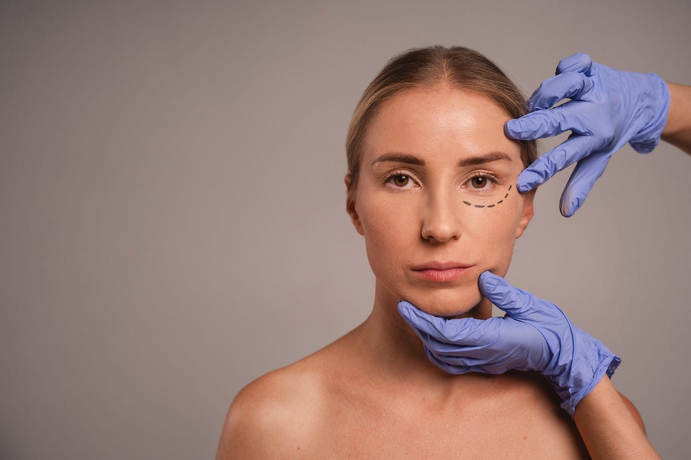 Facelift Thyroid Surgery: What It Is and Who It’s For
