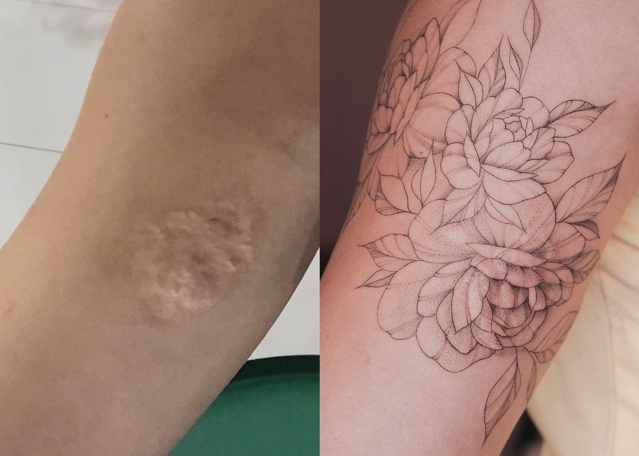 From Scar to Art: The Power of Tattoo Cover-Up, by Anastasiia Koviazina