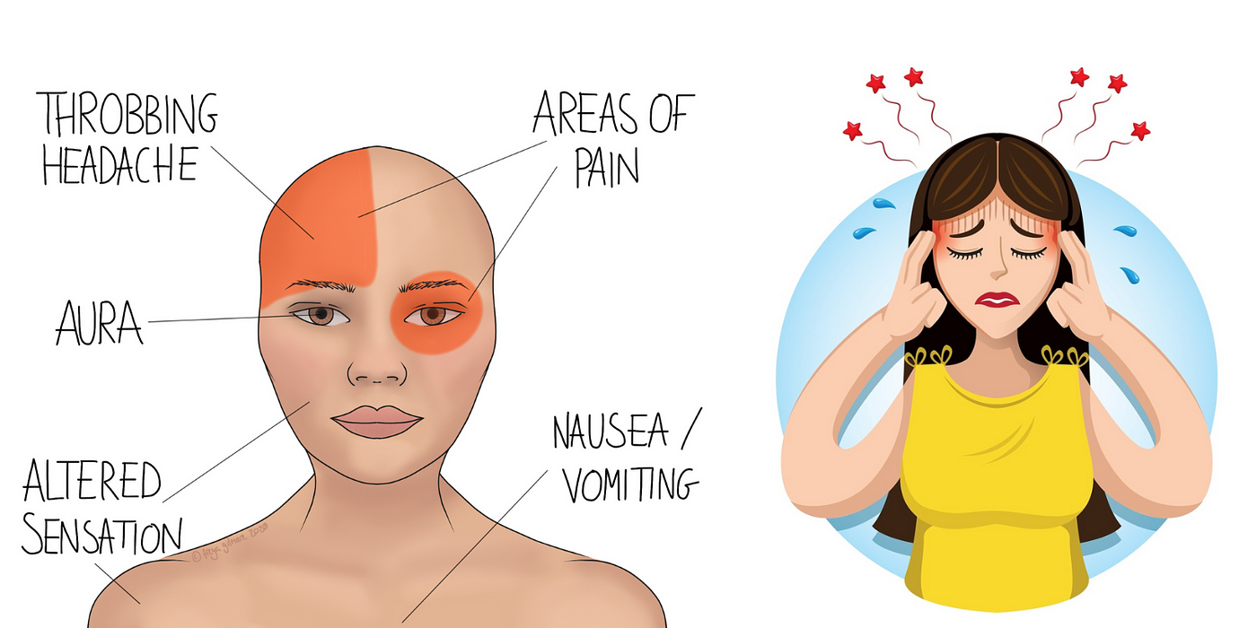 Throbbing Headaches: Unlocking Relief For You In 2024 | by Acetaminophen  butalbital | Medium