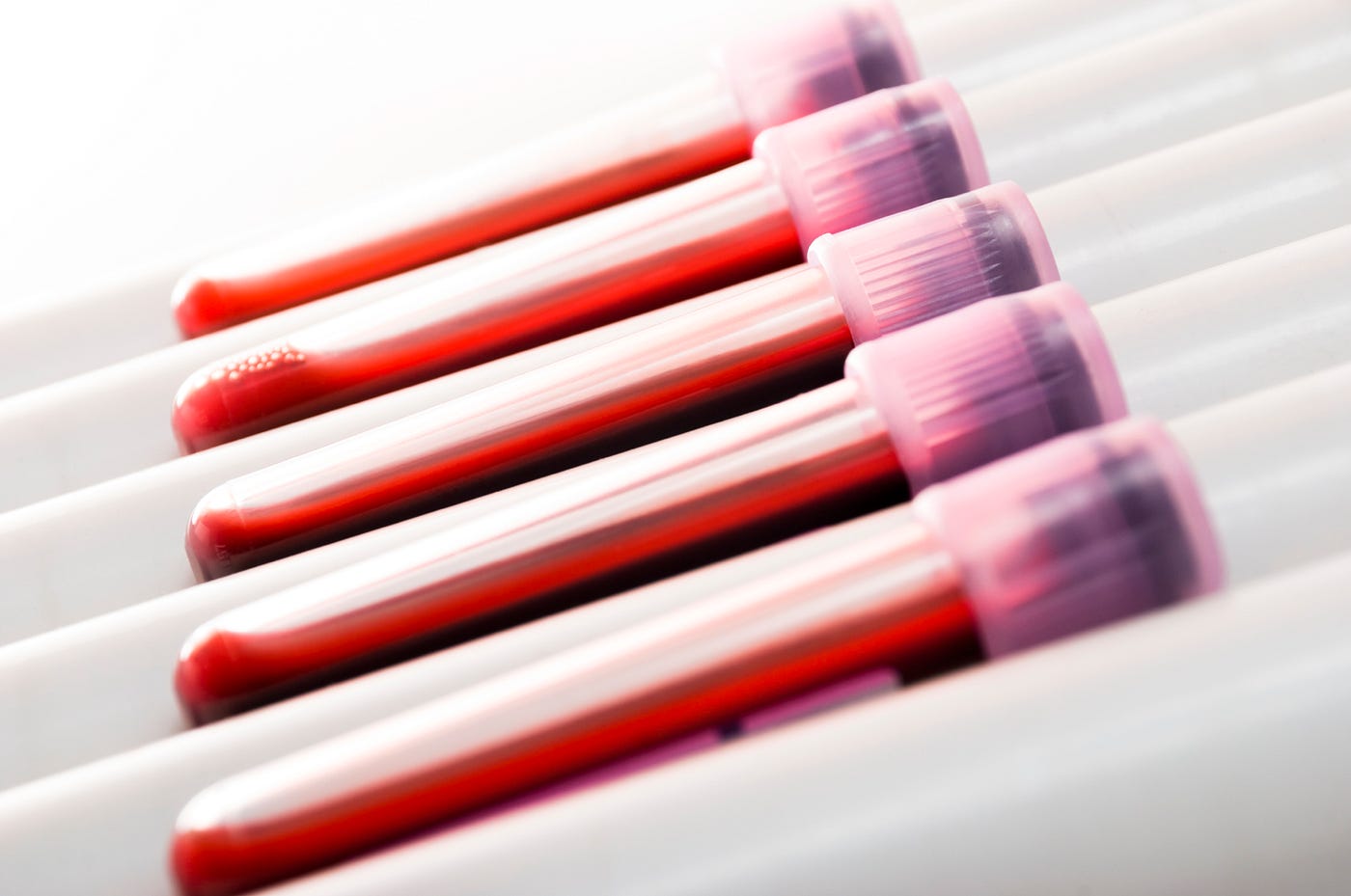Liquid biopsies in cancer