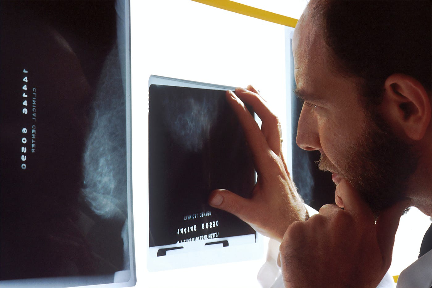 Mammogram Technician Discusses Knockers All Day