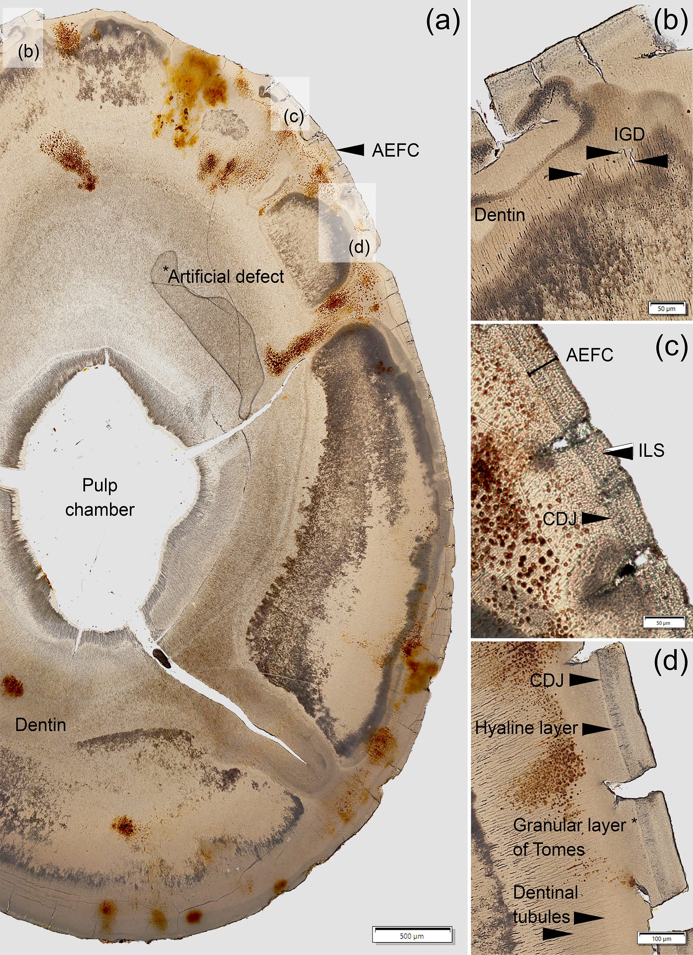 Microscope views of thin tooth root slices, showing thickness of type of tooth cementum (AEFC/acellular extrinsic fibre cementum thickness), the growth lines (ILS/Incremental Lines of Salter), the boundary where that layer meets the dentine beneath it (CDJ/Cemento-Dentinal Junction), and small irregular pockets within the dentine (IGD/Interglobular Dentine). Credit: Hałuszko et al. 2026