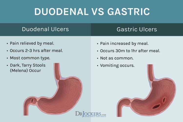 gastric ulcer types