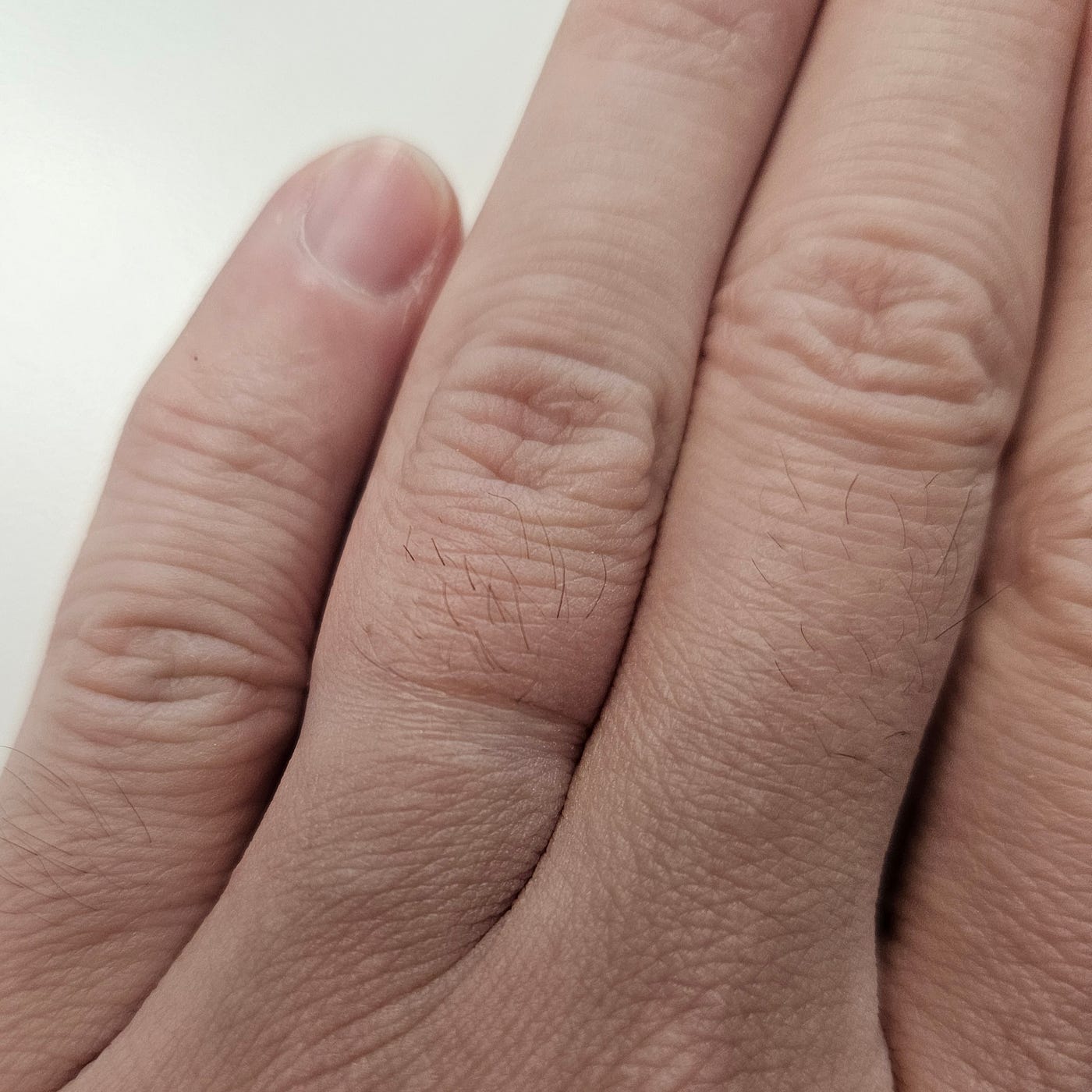 Marriage Review Year 5 : Ring Indentation | by A Curious Can of Warmth |  Medium