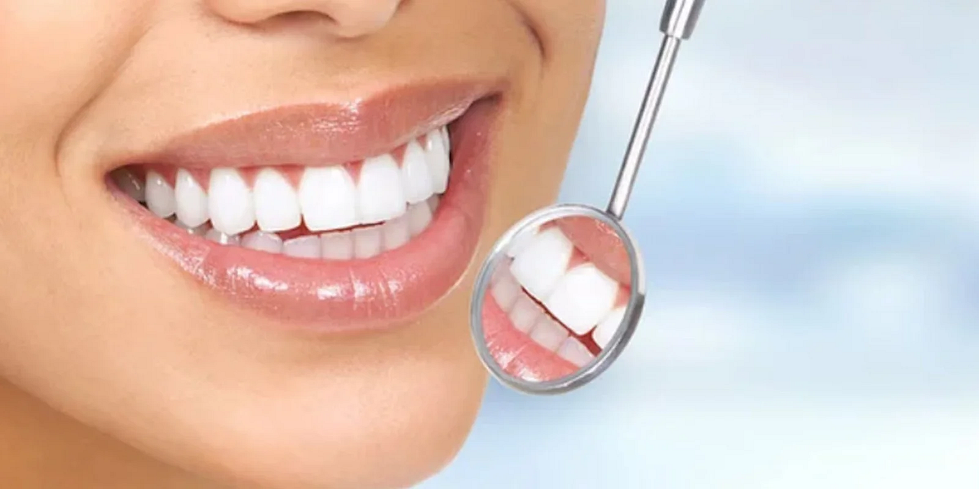 best smile makeover treatment in hubli