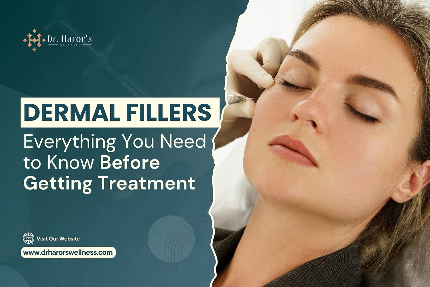 Dermal Fillers: Everything You Need to Know Before Getting Treatment