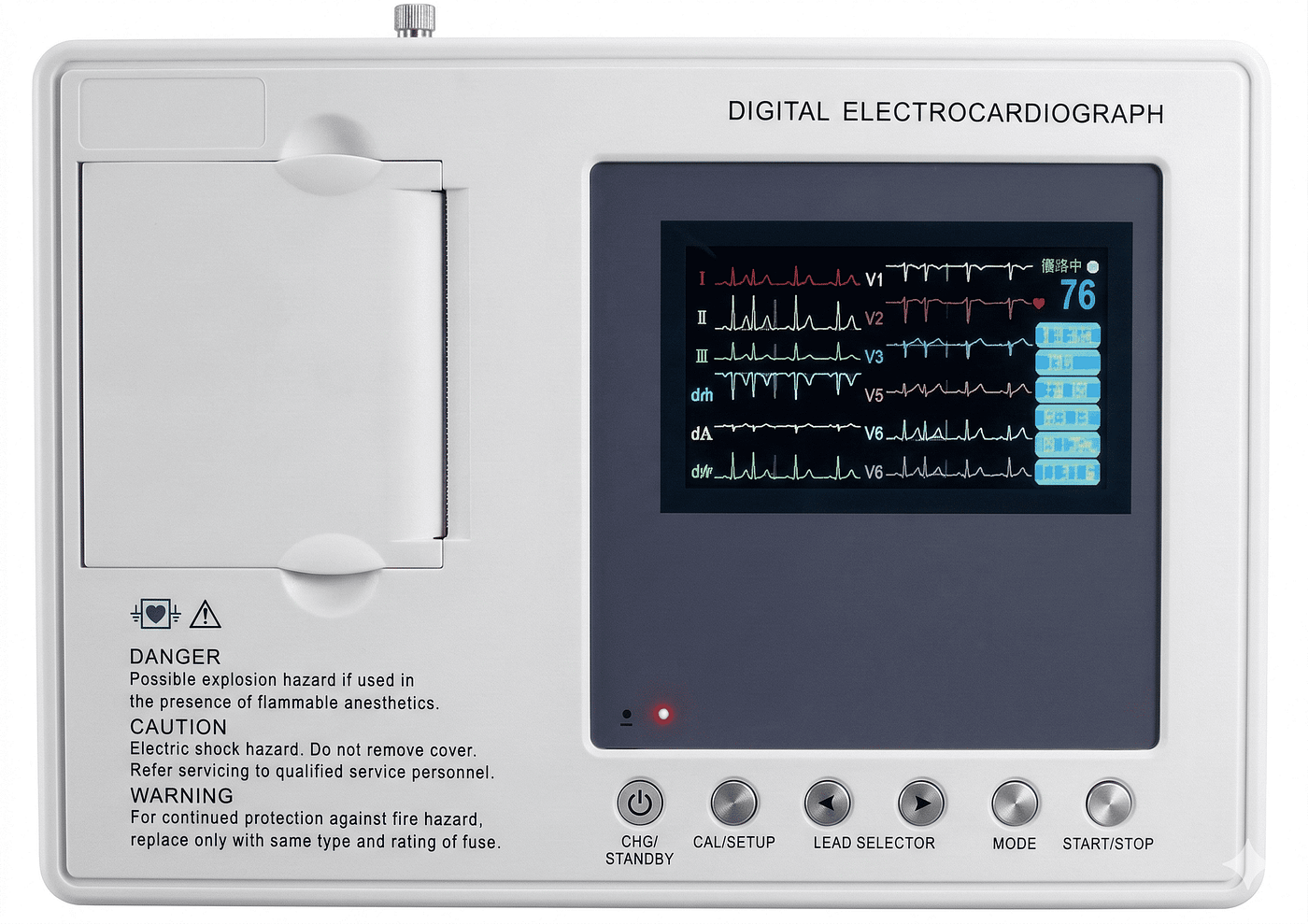 How to Choose the Right ECG Machine for Your Clinic or Hospital