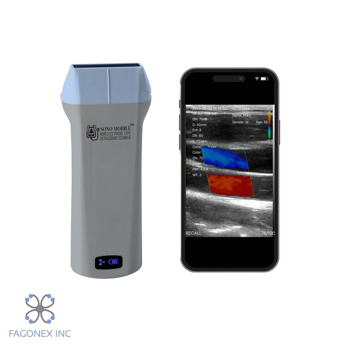 Fagonex: Innovation in Mobile Ultrasound with Sono Mobile™️