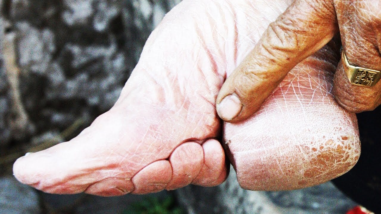The Disturbing Tradition of Foot Binding in China | Short History