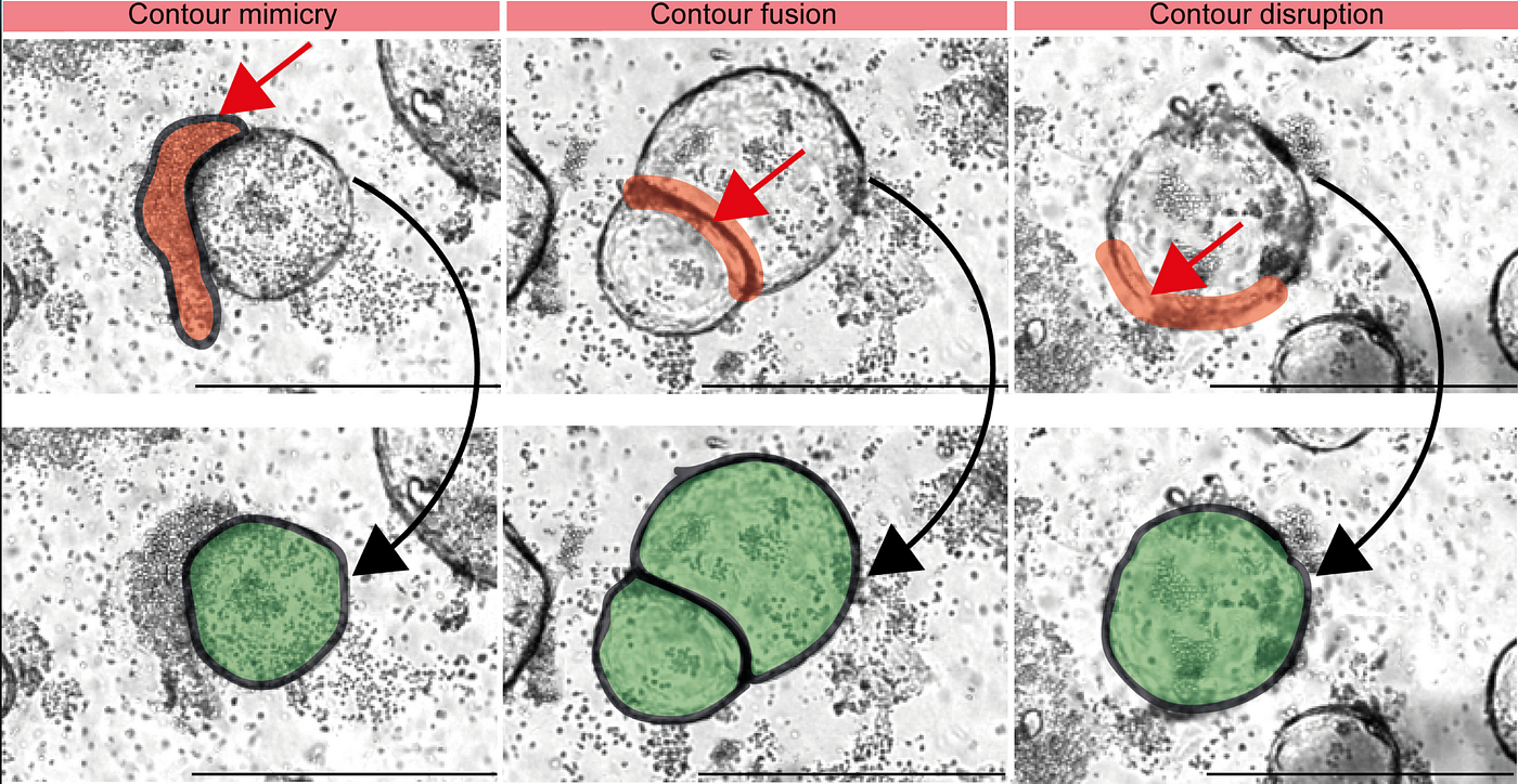Analysis of Organoid and Immune Cell Co-cultures by Machine Learning-empowered Image Cytometry