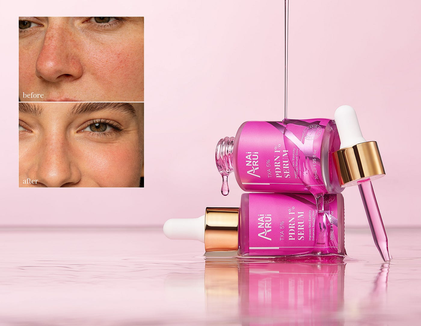 What Is PDRN? A Complete Guide to This Breakthrough Skincare Ingredient