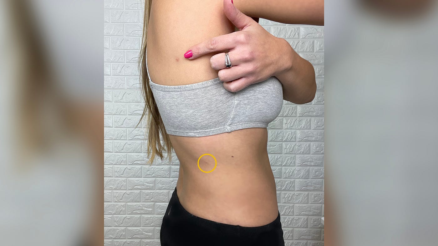 Airsculpt 2-Year Review: Would I do it all over again? (Before & After  Included), by Steph C. Martinez