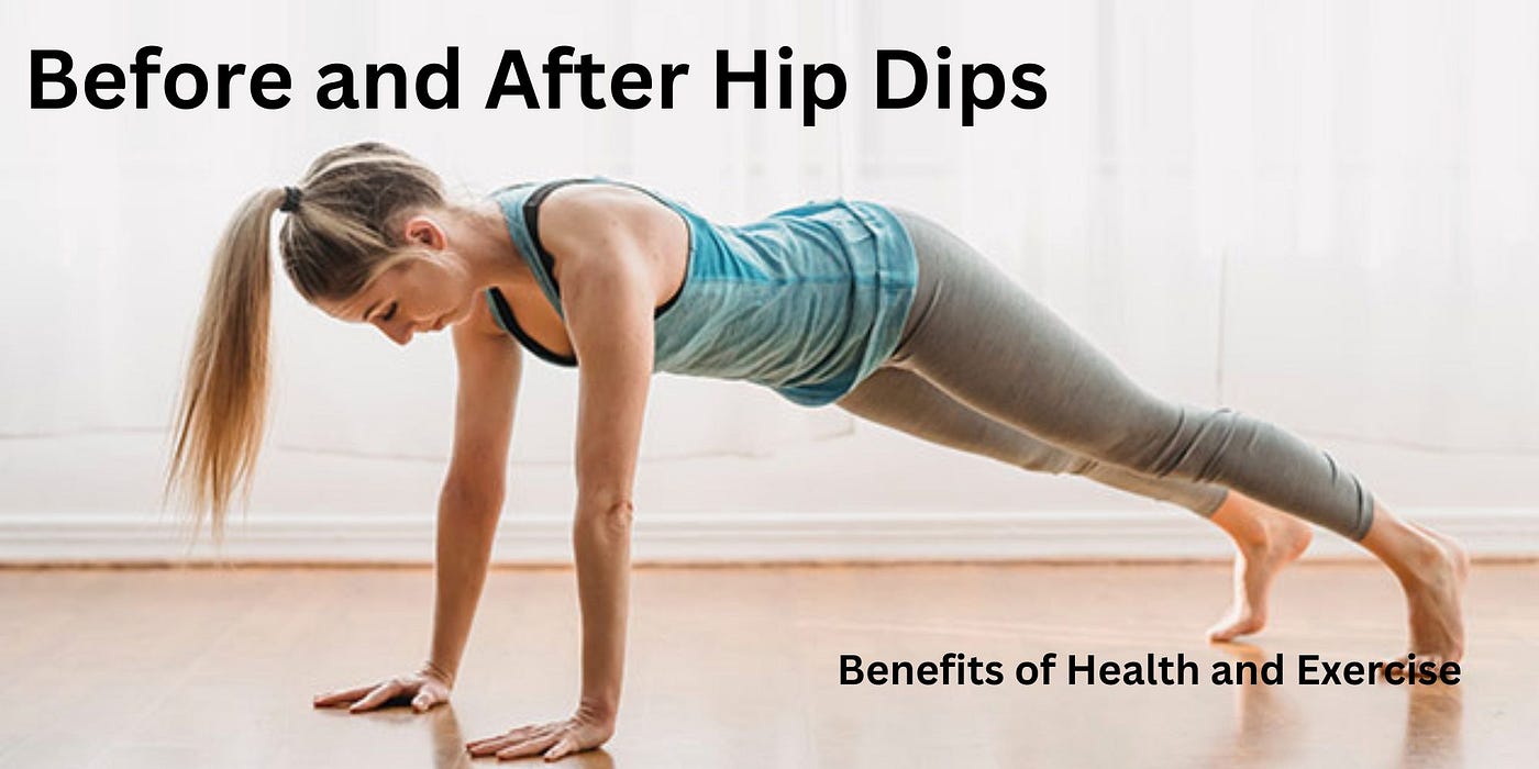Before and After Hip Dips. Before and After Hip Dips