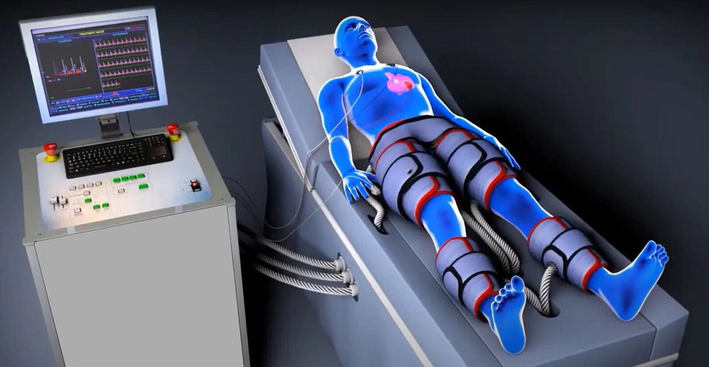 Enhanced External Counter Pulsation (EECP) — A Comprehensive Guide