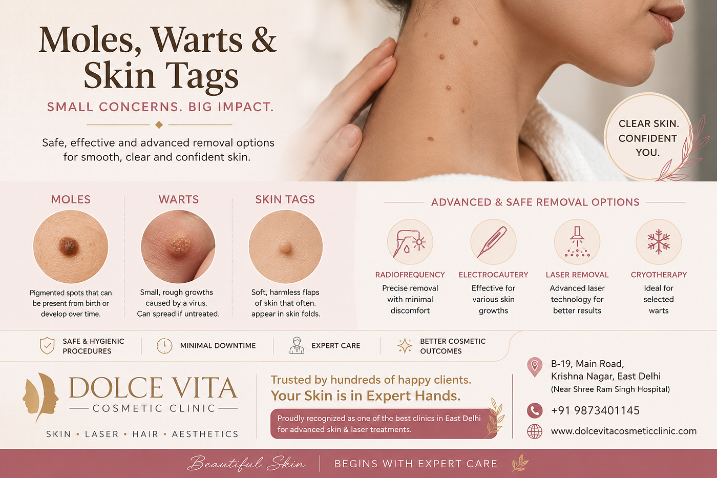 Moles, Warts & Skin Tags: Understanding the Difference and Safe Removal Options