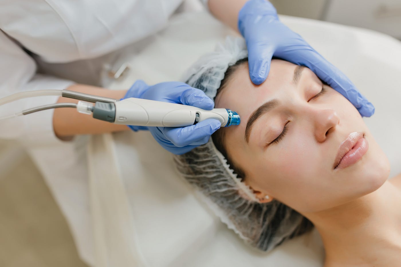 De ce microneedlingul face mai mult pentru pielea ta decât orice cremă scumpă