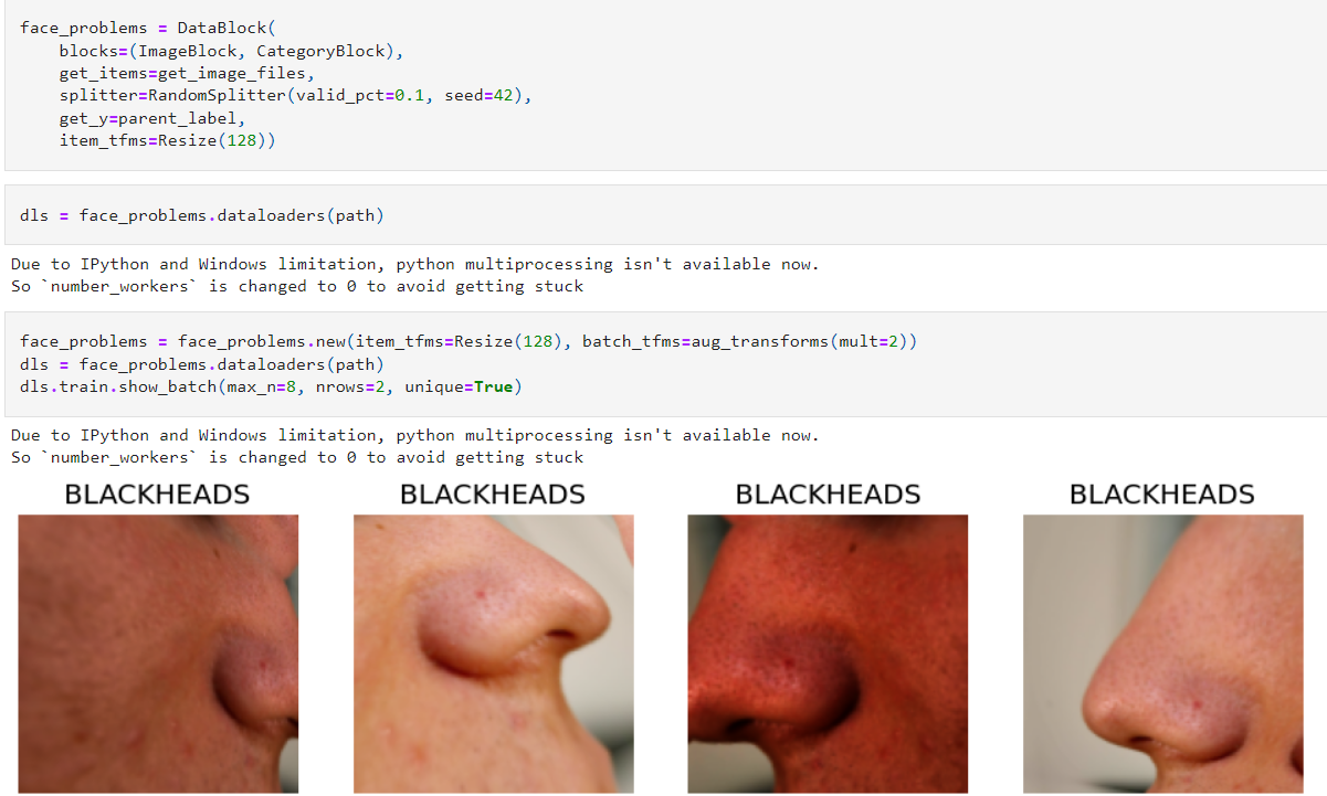 Face skin analyzer with Fast.ai and Gradio | by Pratik Smitin Karnik |  Becoming Human: Artificial Intelligence Magazine