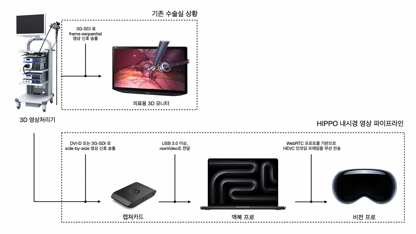 HIPPO는 Vision Pro에서 3D내시경 영상을 어떻게 출력하나요?
