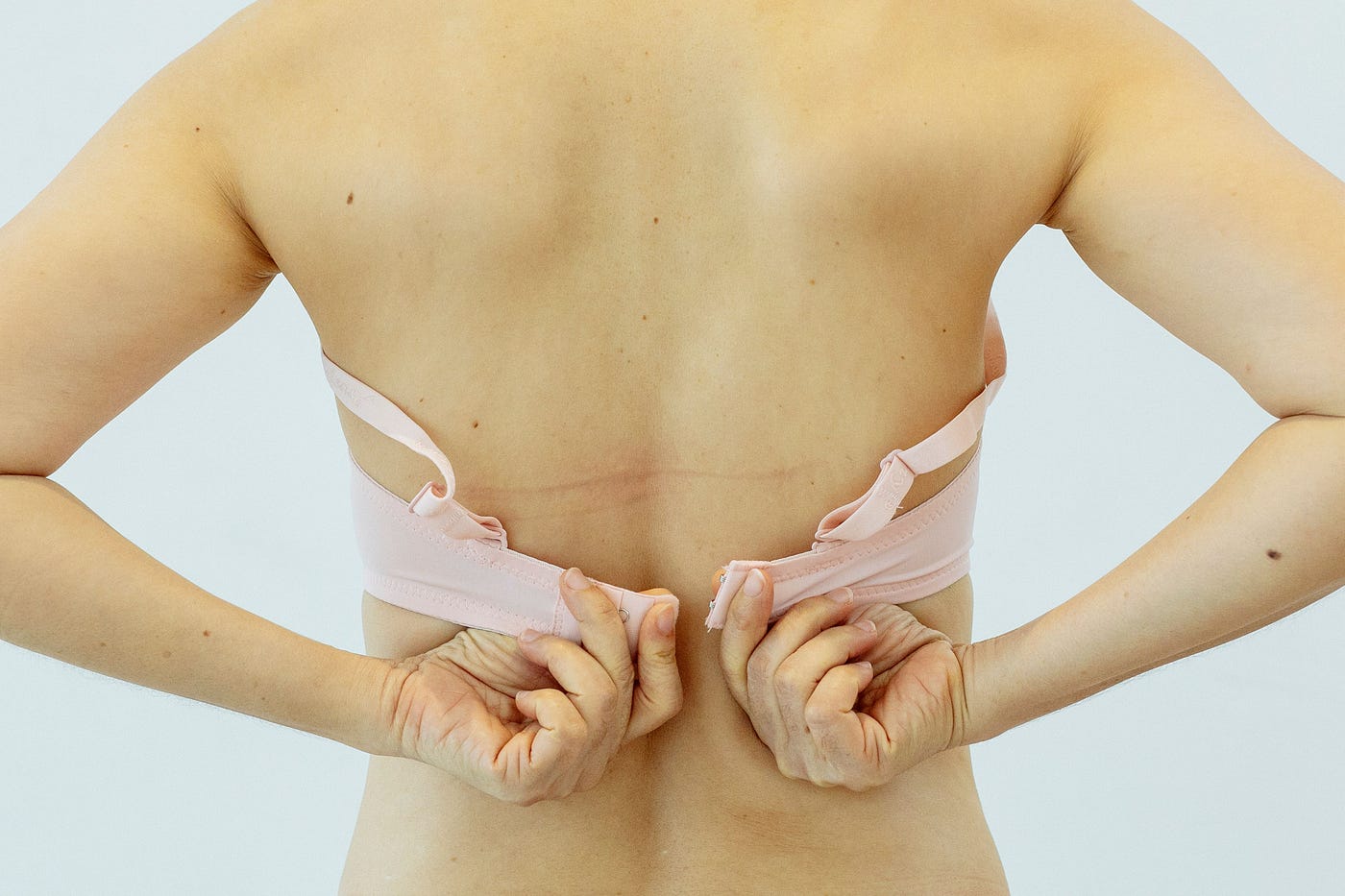 Bra Abrasion: What It Is and How to Treat It, by Bucky's Life Stories