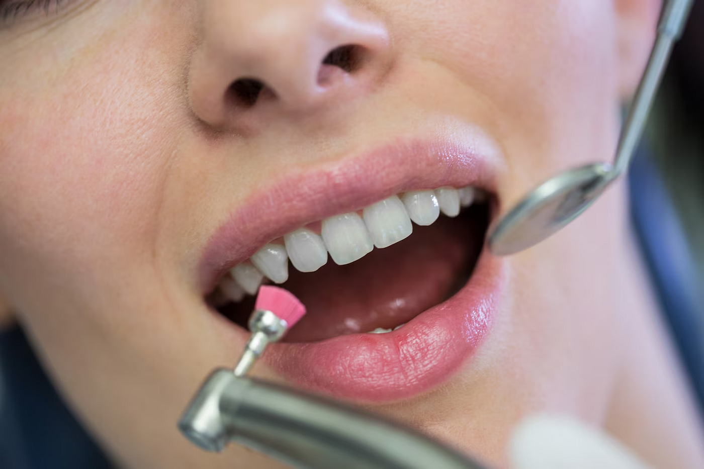 Teeth Cleaning vs. Teeth Whitening: What’s the Difference?